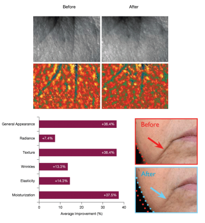 Epidermosil