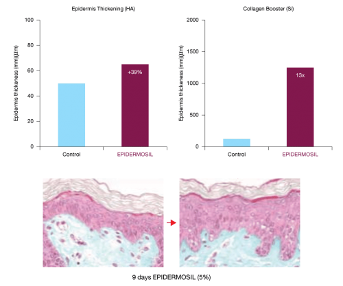 Epidermosil1